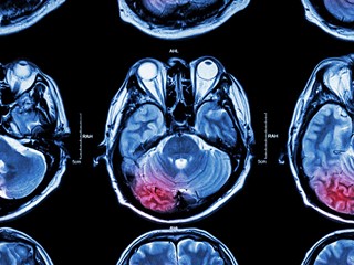 Considering the Silence of Teenage Boys in the Wake of My Son’s Traumatic Injury