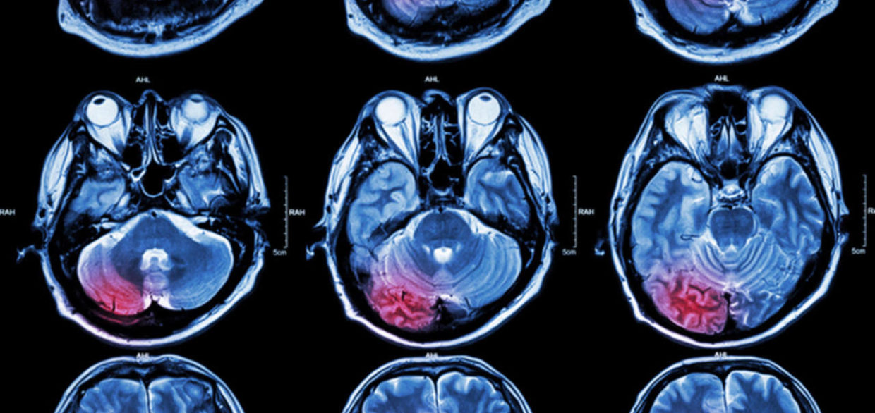 Considering the Silence of Teenage Boys in the Wake of My Son’s Traumatic Injury